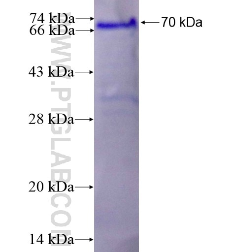 CORIN fusion protein Ag15898 SDS-PAGE