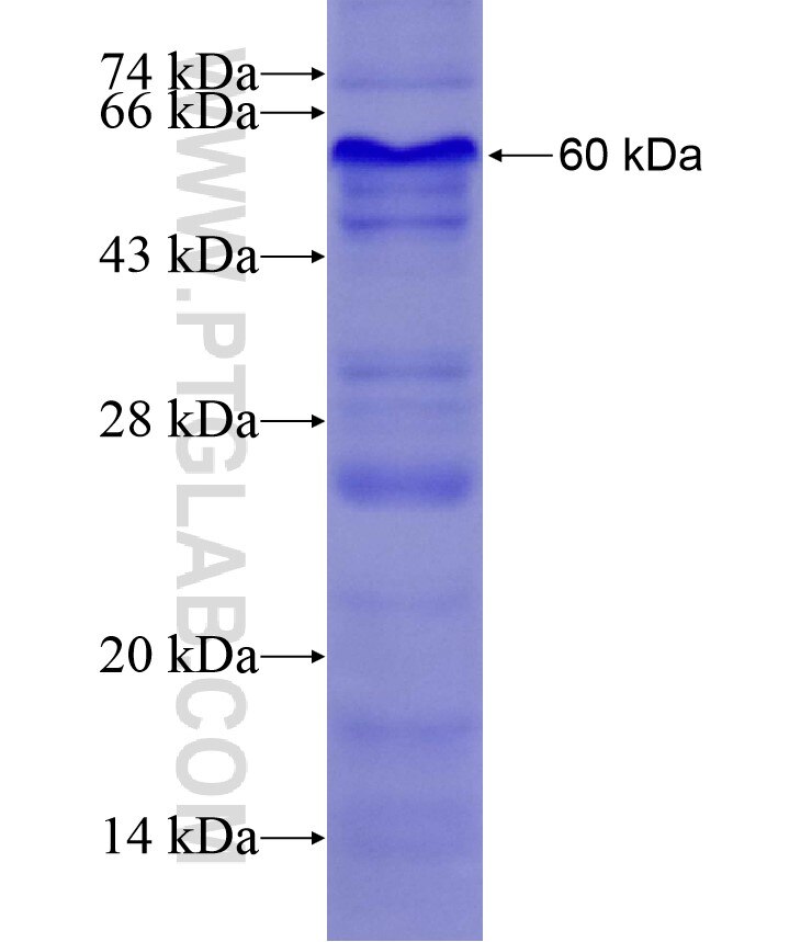 CORIN fusion protein Ag17059 SDS-PAGE