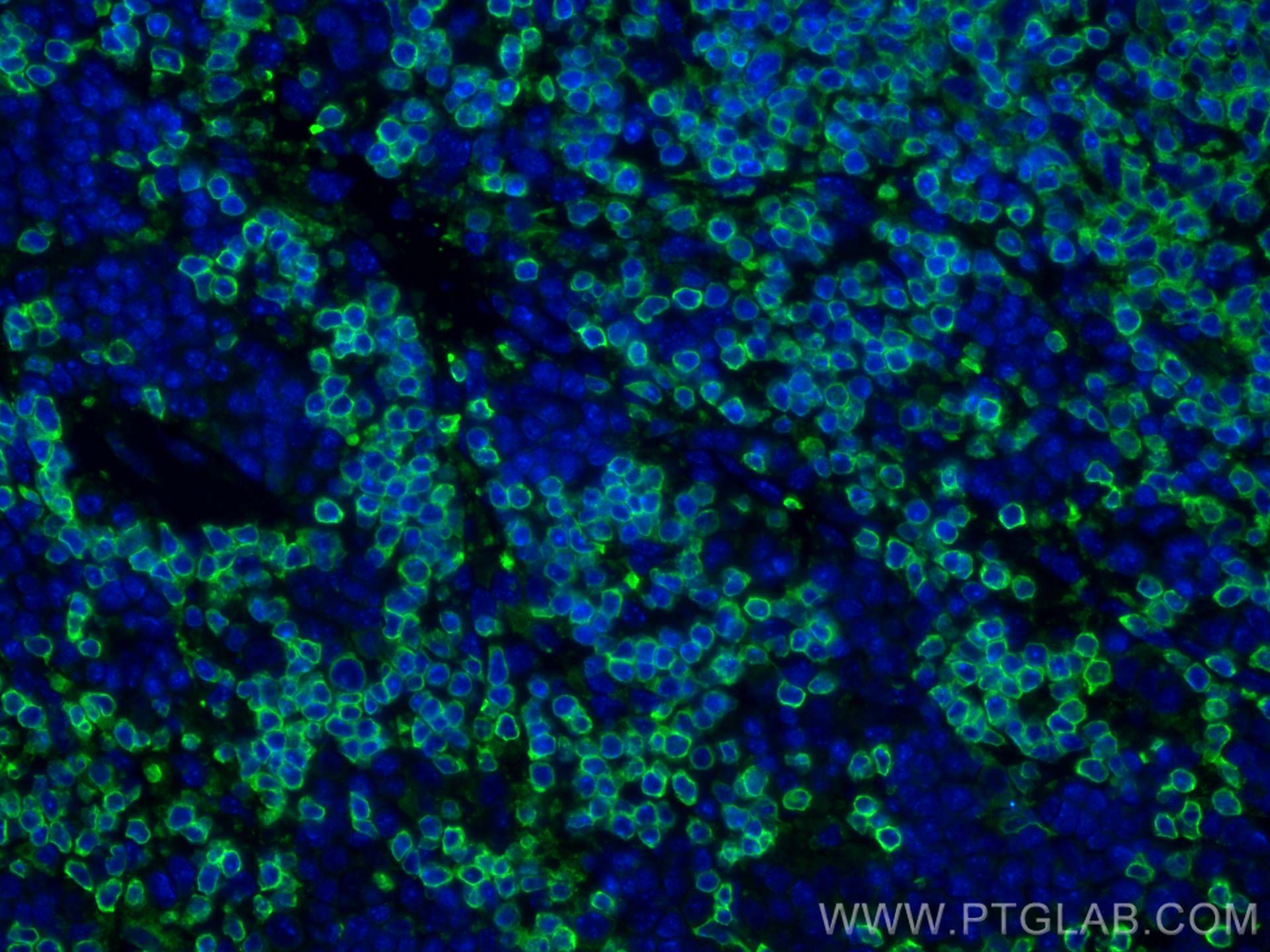 Immunofluorescence (IF) / fluorescent staining of mouse spleen tissue using CORO1A Polyclonal antibody (17760-1-AP)