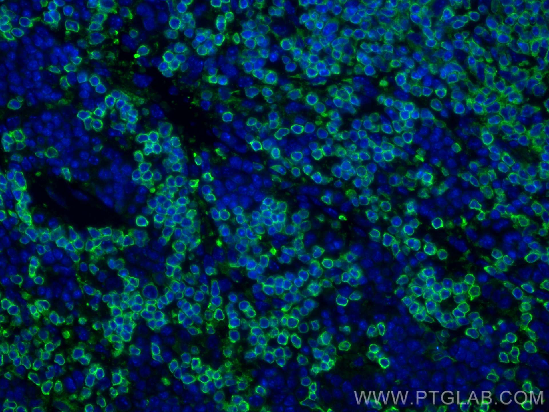 IF Staining of mouse spleen using 17760-1-AP