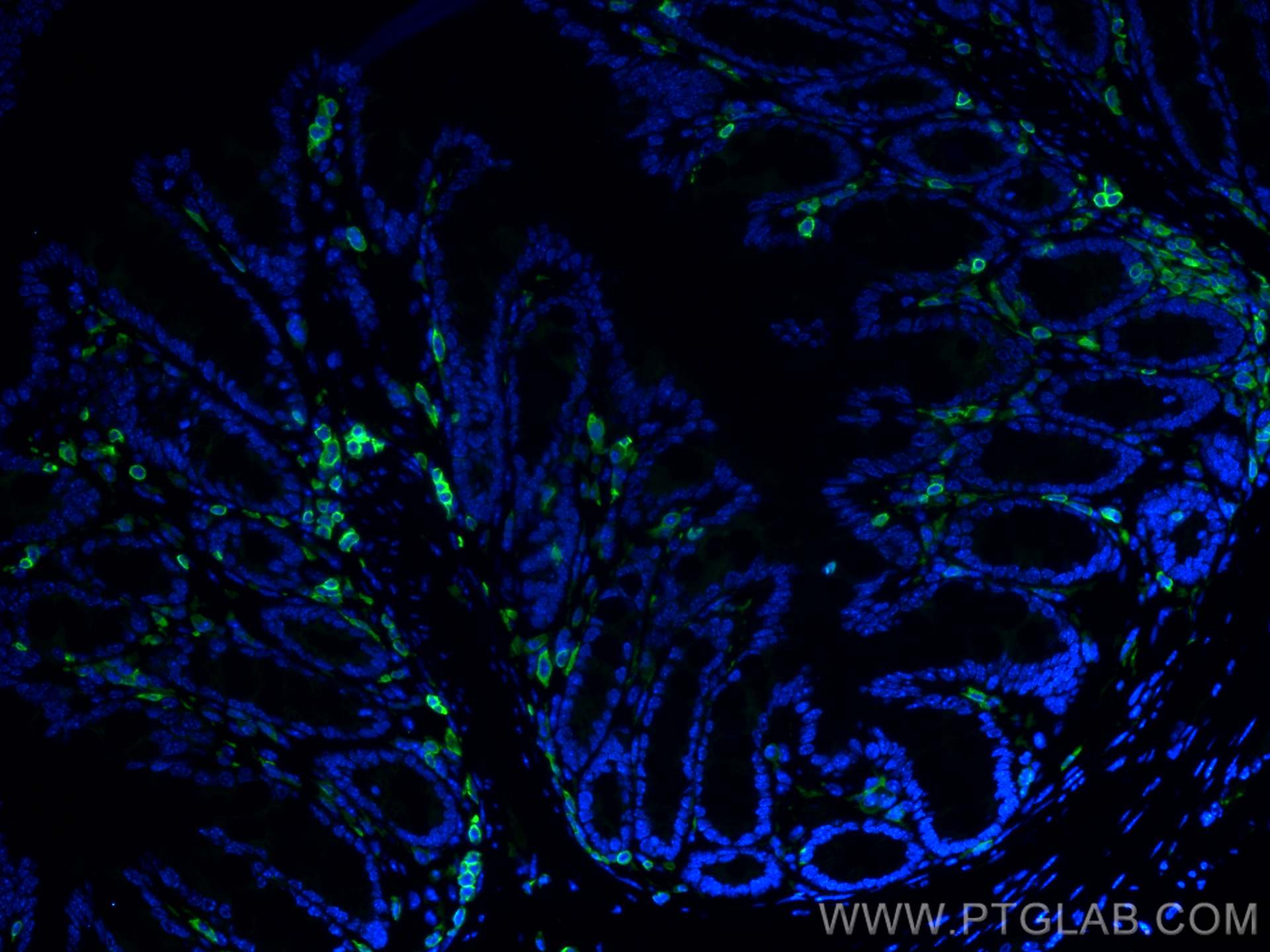 Immunofluorescence (IF) / fluorescent staining of mouse colon tissue using CORO1A Polyclonal antibody (17760-1-AP)