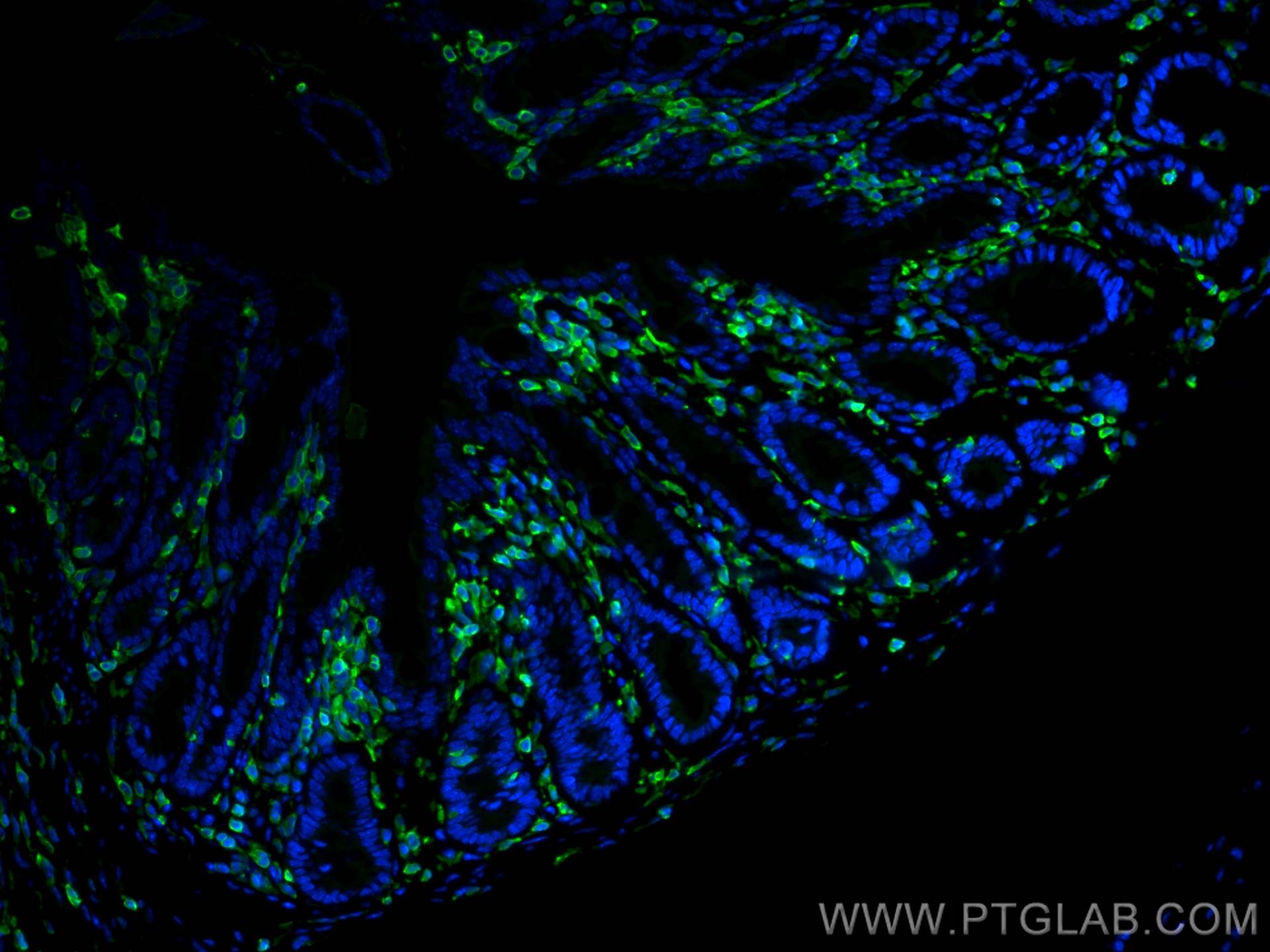 Immunofluorescence (IF) / fluorescent staining of mouse colon tissue using CORO1A Polyclonal antibody (17760-1-AP)