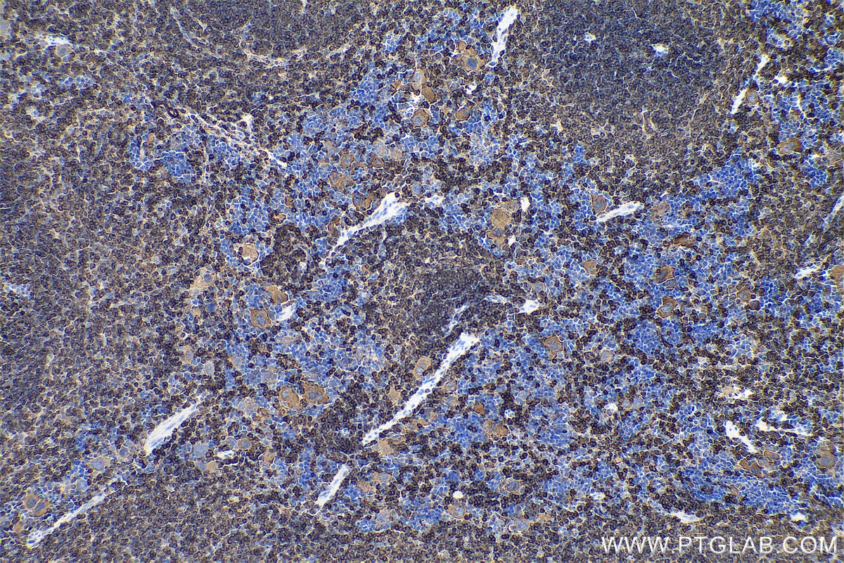 Immunohistochemistry (IHC) staining of mouse spleen tissue using CORO1A Polyclonal antibody (17760-1-AP)