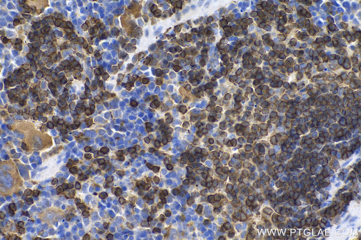 Immunohistochemistry (IHC) staining of mouse spleen tissue using CORO1A Polyclonal antibody (17760-1-AP)