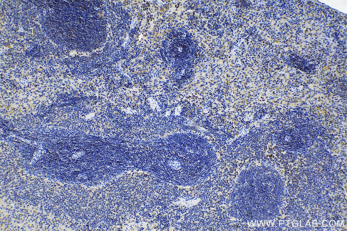 Immunohistochemistry (IHC) staining of rat spleen tissue using CORO1A Polyclonal antibody (17760-1-AP)