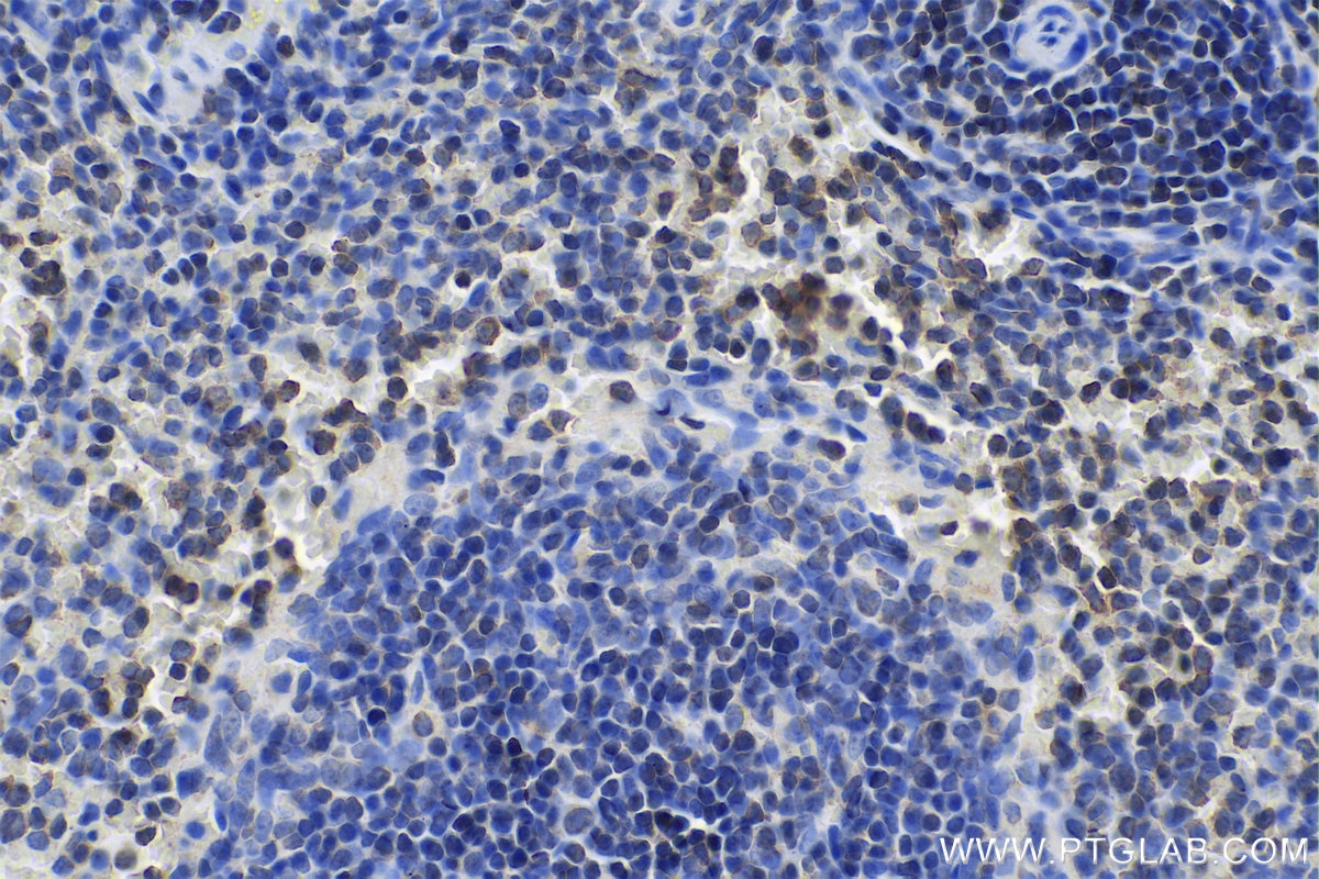 Immunohistochemistry (IHC) staining of rat spleen tissue using CORO1A Polyclonal antibody (17760-1-AP)