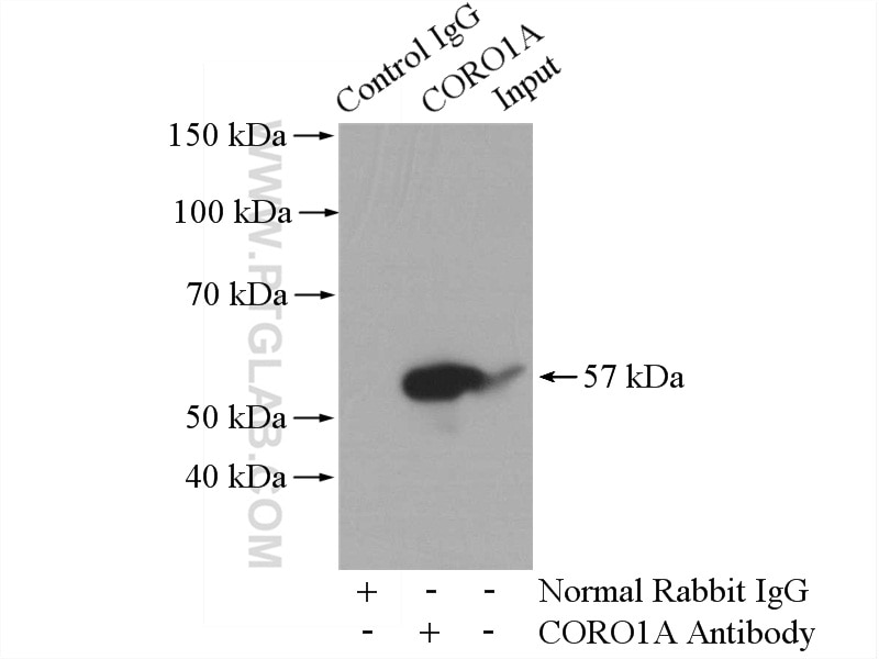 Immunoprecipitation (IP) experiment of mouse spleen tissue using CORO1A Polyclonal antibody (17760-1-AP)