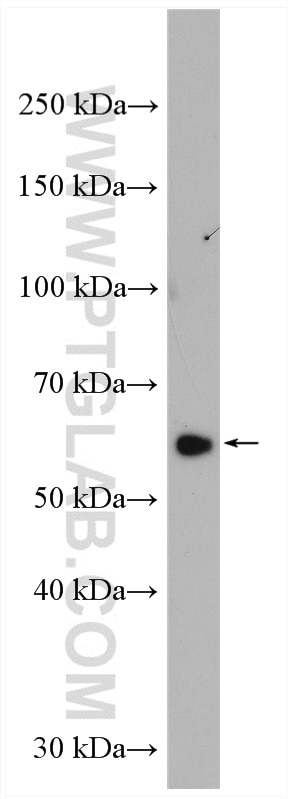 Western Blot (WB) analysis of rat brain tissue using CORO1A Polyclonal antibody (17760-1-AP)