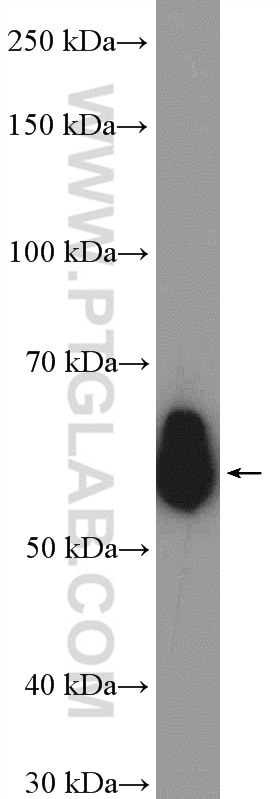 Western Blot (WB) analysis of rat spleen tissue using CORO1A Polyclonal antibody (17760-1-AP)