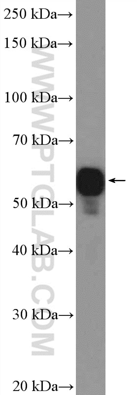 Western Blot (WB) analysis of mouse spleen tissue using CORO1A Polyclonal antibody (17760-1-AP)