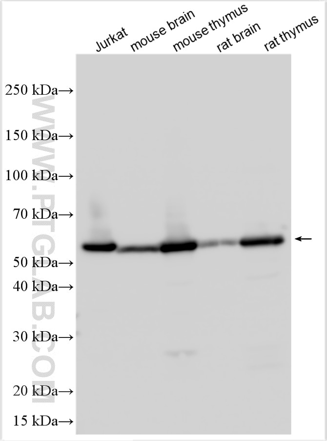 Western Blot (WB) analysis of various lysates using CORO1A Polyclonal antibody (17760-1-AP)