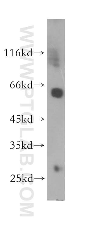 Western Blot (WB) analysis of Jurkat cells using CORO1A Polyclonal antibody (17760-1-AP)