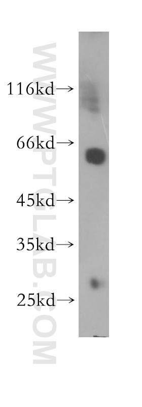 WB analysis of Jurkat using 17760-1-AP