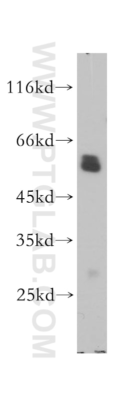 Western Blot (WB) analysis of HL-60 cells using CORO1A Polyclonal antibody (17760-1-AP)