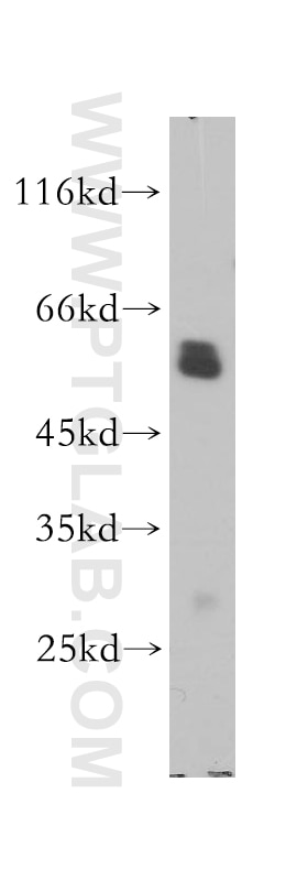 WB analysis of HL-60 using 17760-1-AP