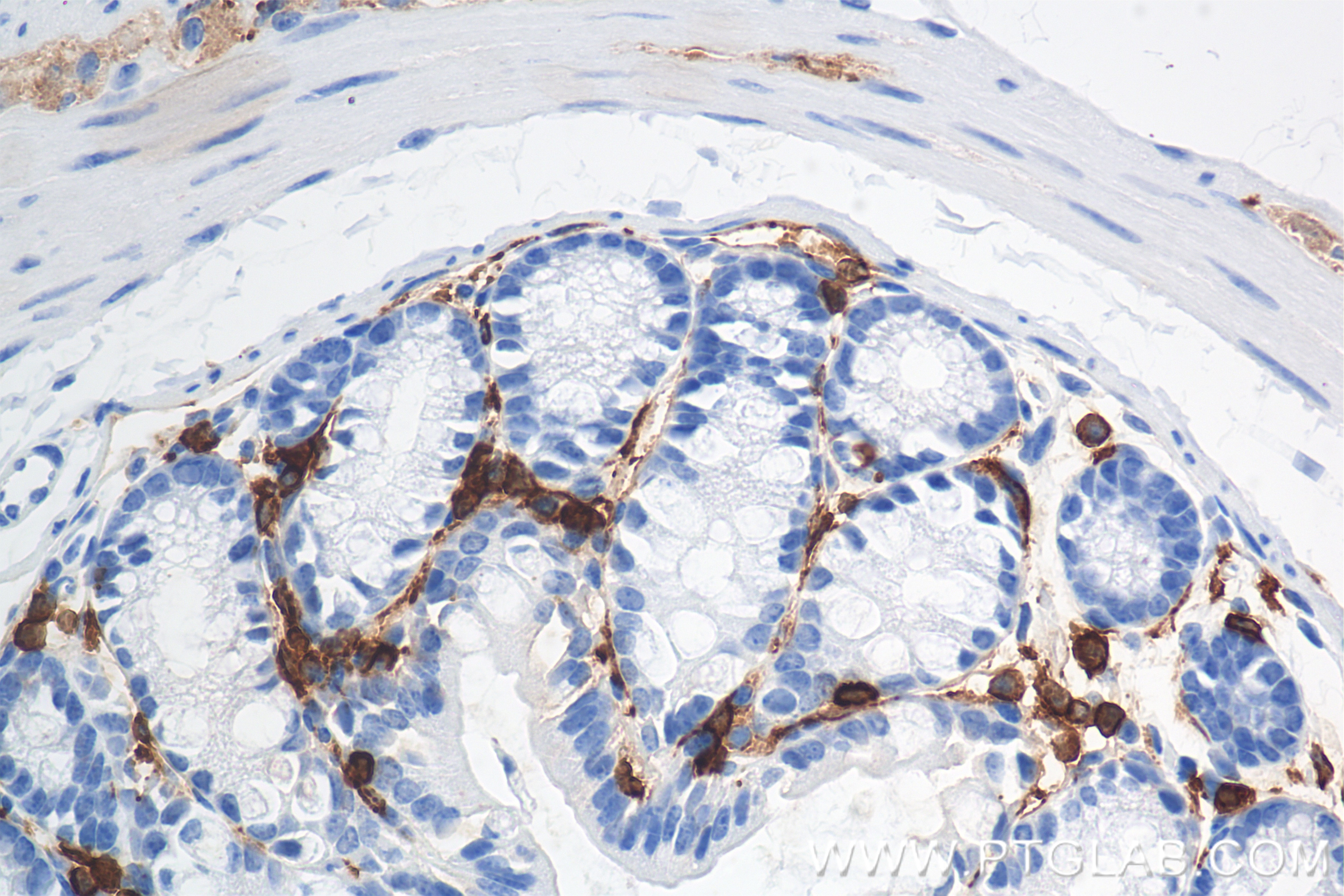 Immunohistochemistry (IHC) staining of mouse colon tissue using CORO1A Recombinant antibody (84602-5-RR)
