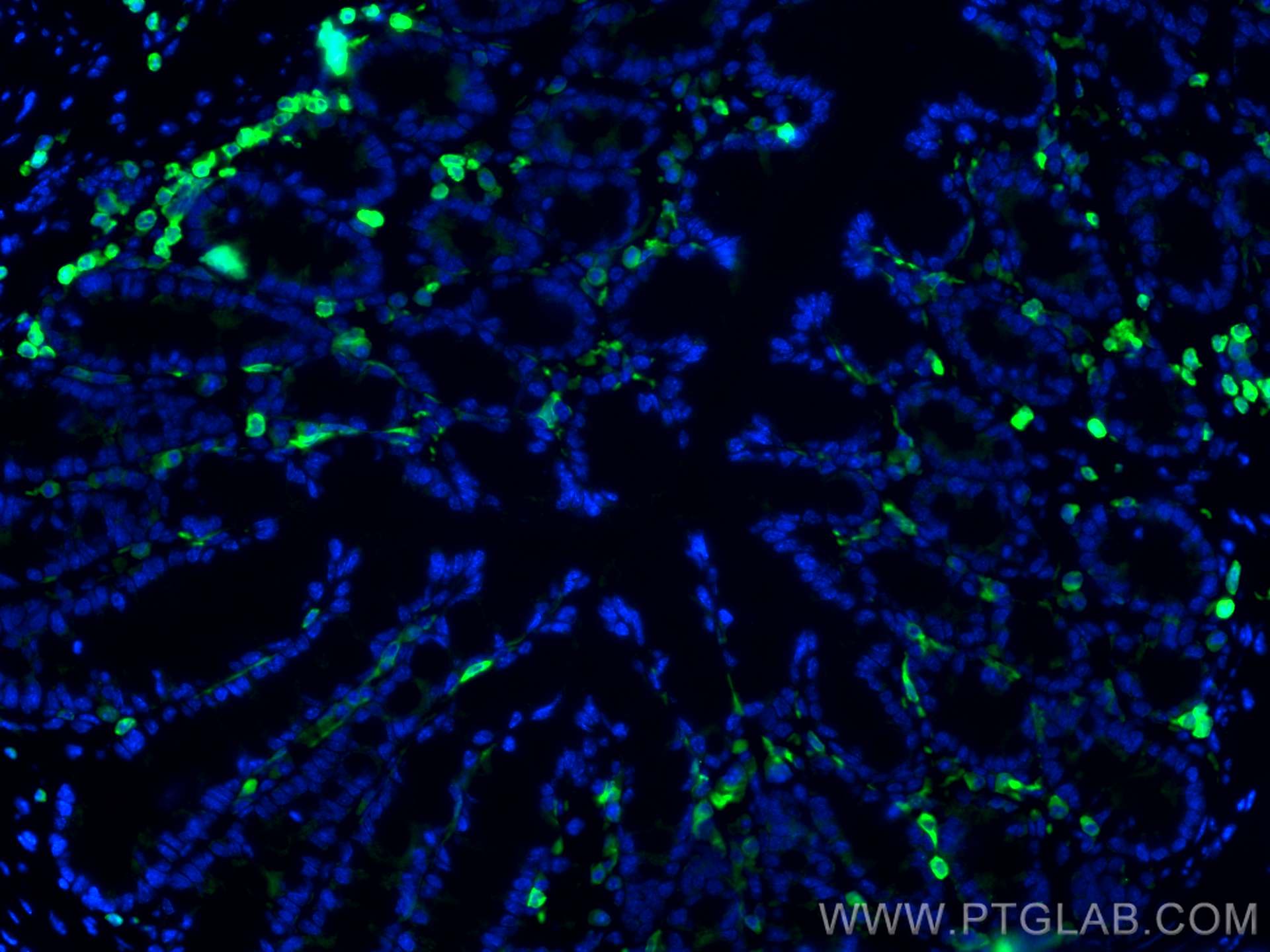 Immunofluorescence (IF) / fluorescent staining of human colon tissue using CoraLite® Plus 488-conjugated CORO1A Polyclonal an (CL488-17760)