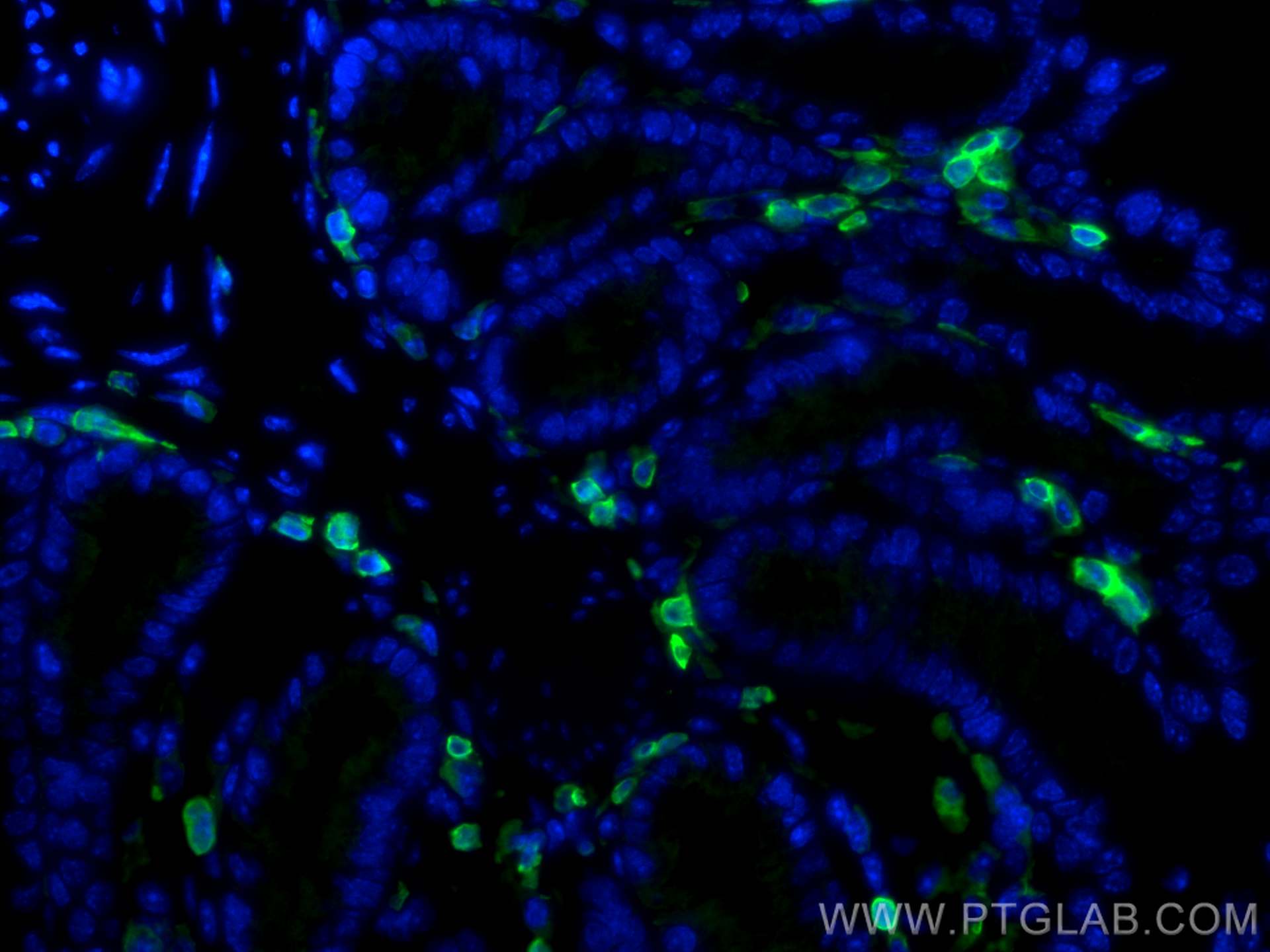 Immunofluorescence (IF) / fluorescent staining of human colon tissue using CoraLite® Plus 488-conjugated CORO1A Polyclonal an (CL488-17760)