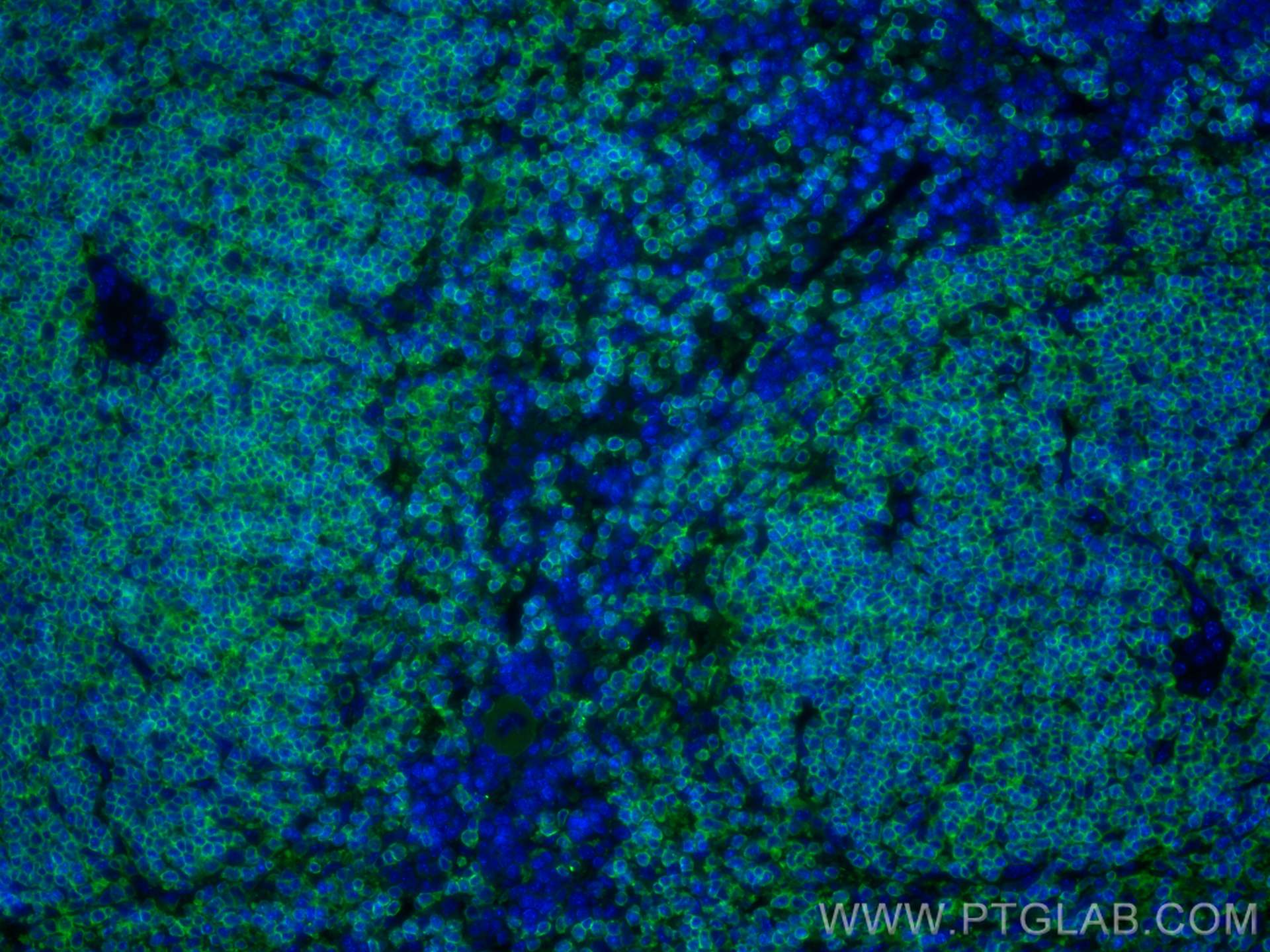 IF Staining of mouse spleen using CL488-17760