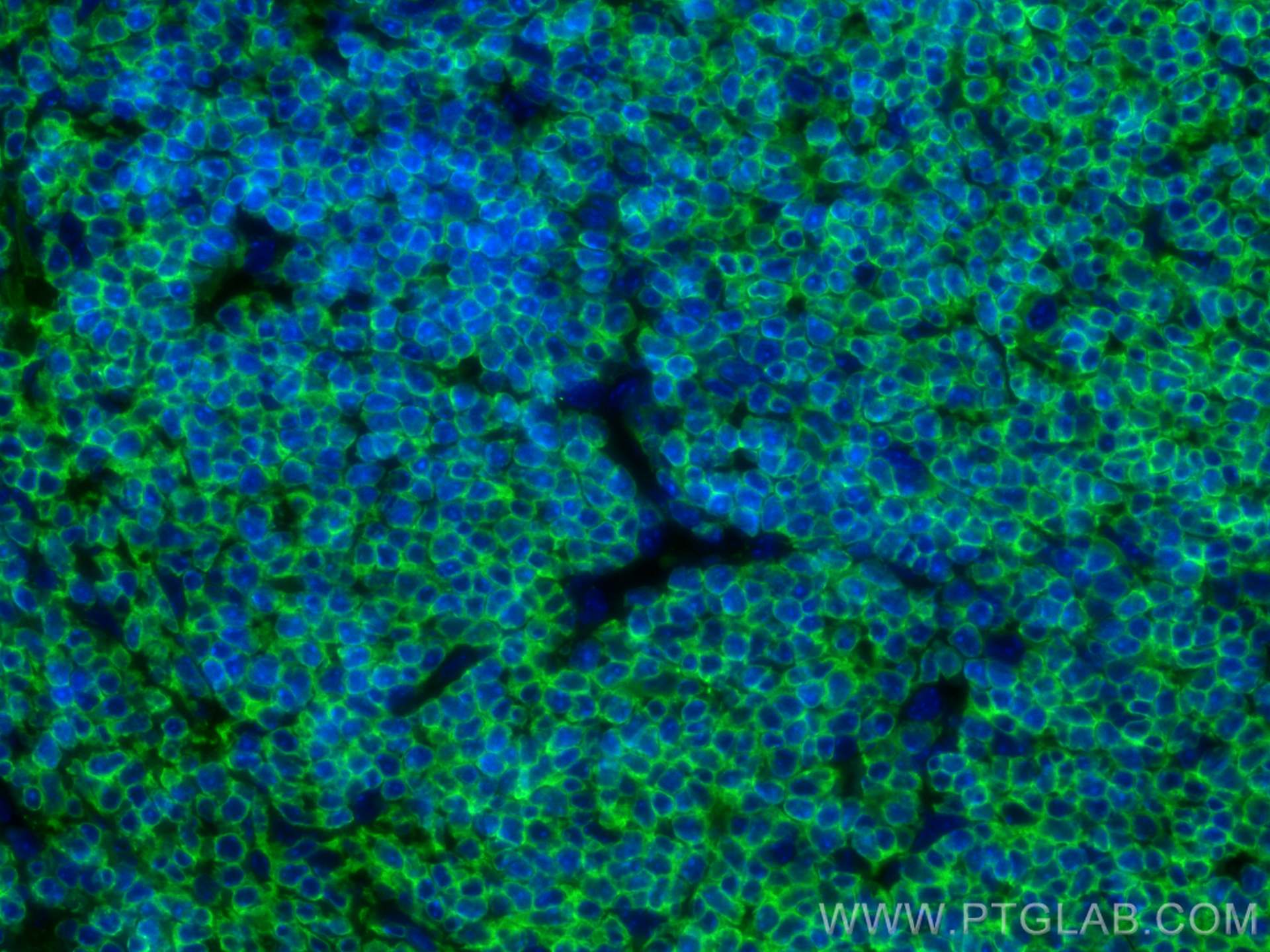 Immunofluorescence (IF) / fluorescent staining of mouse spleen tissue using CoraLite® Plus 488-conjugated CORO1A Polyclonal an (CL488-17760)