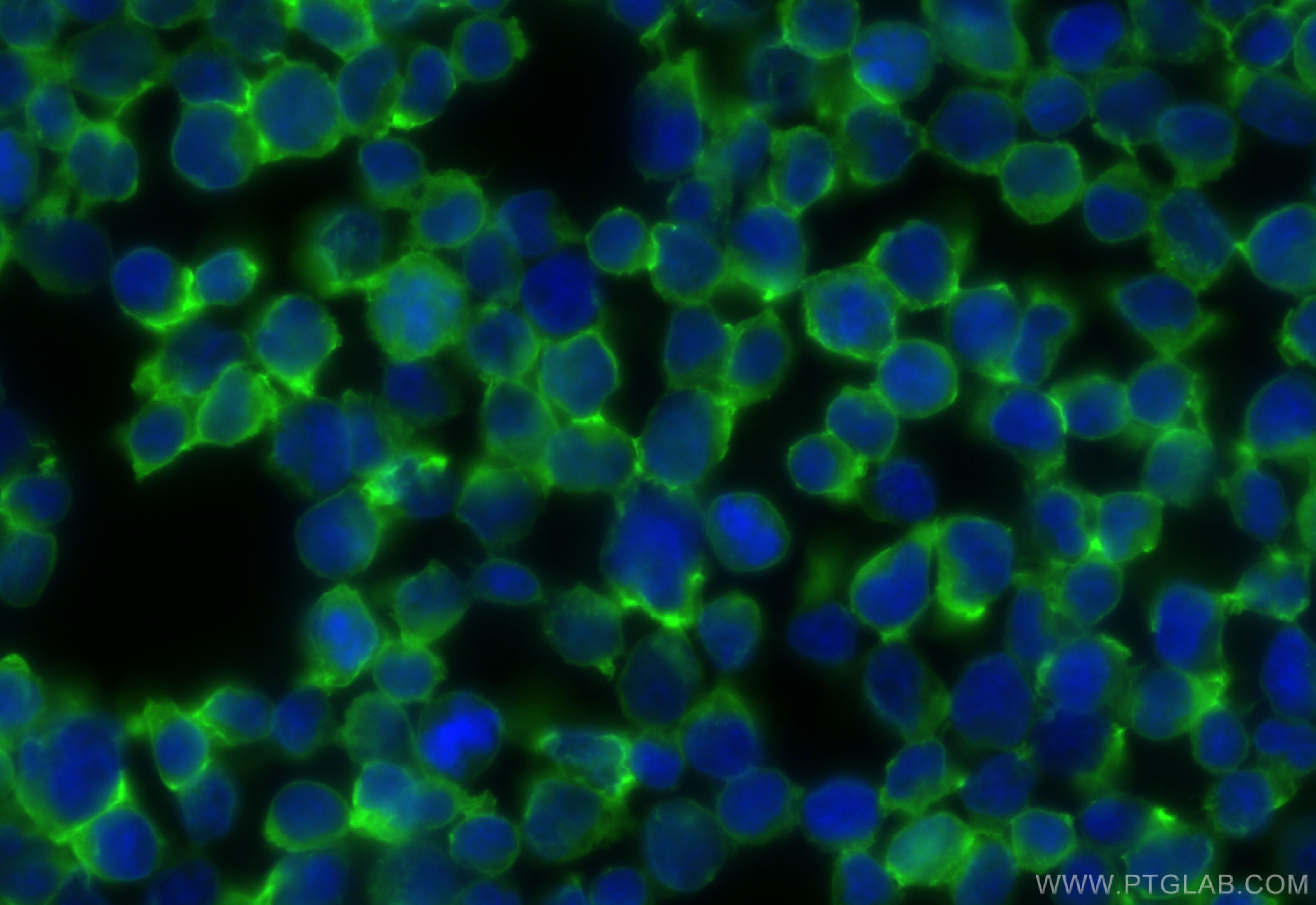 Immunofluorescence (IF) / fluorescent staining of Jurkat cells using CoraLite® Plus 488-conjugated CORO1A Recombinant a (CL488-84602-5)