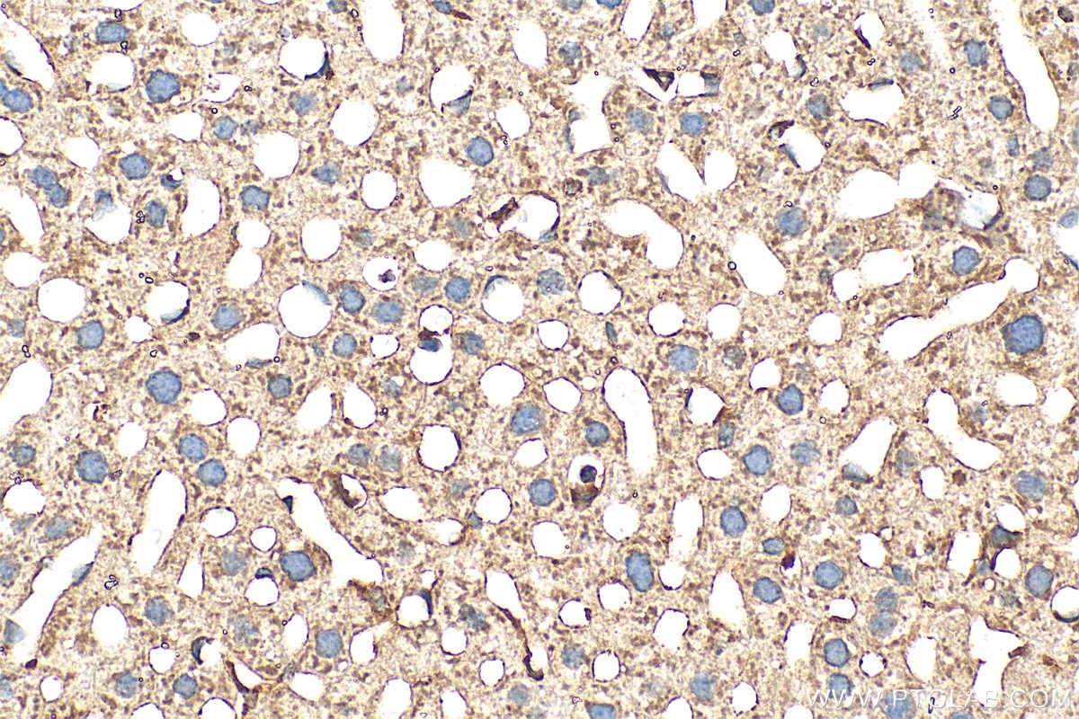 Immunohistochemistry (IHC) staining of mouse liver tissue using CORO1B Polyclonal antibody (31091-1-AP)