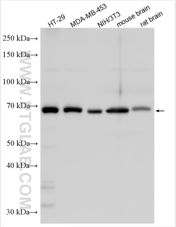Western Blot (WB) analysis of various lysates using CORO1B Polyclonal antibody (31091-1-AP)