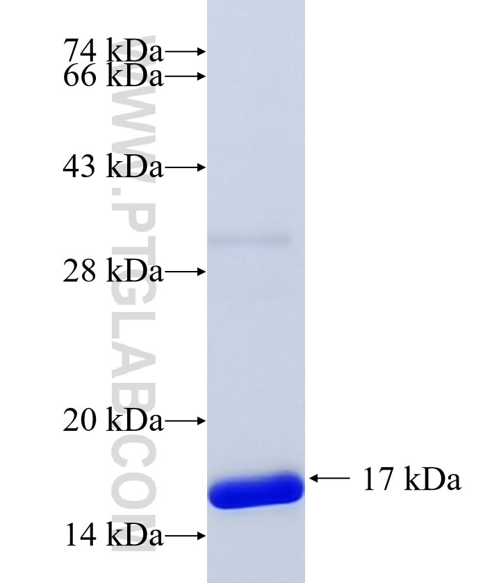CORO1B fusion protein Ag35134 SDS-PAGE CORO1B fusion protein Ag35134 SDS-PAGE