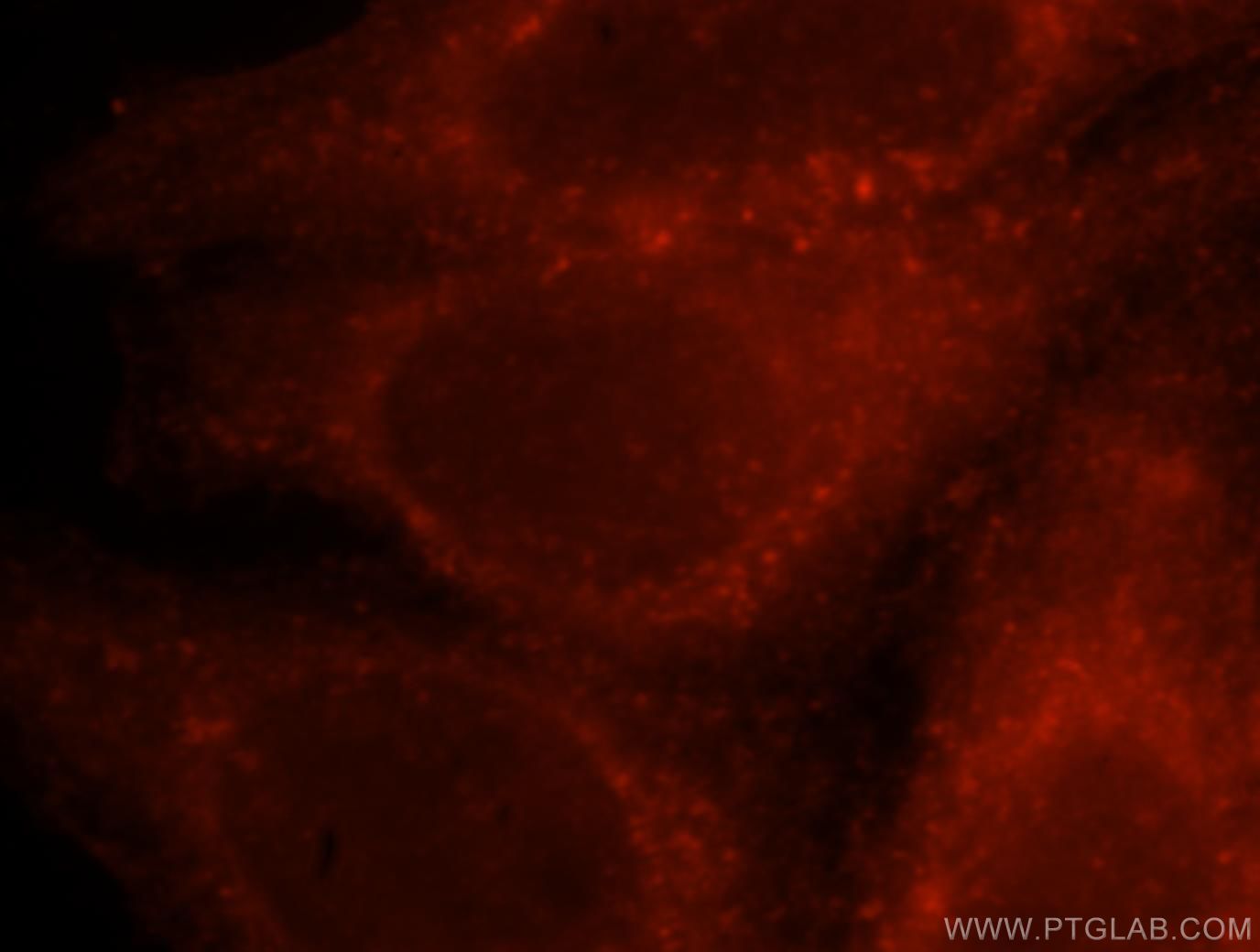 Immunofluorescence (IF) / fluorescent staining of HepG2 cells using CORO1C Polyclonal antibody (14749-1-AP)