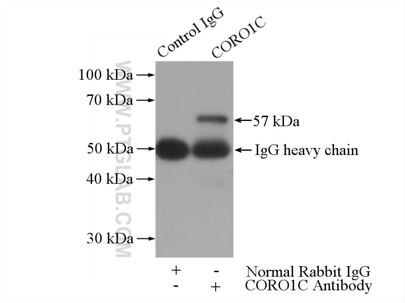 Immunoprecipitation (IP) experiment of mouse skeletal muscle tissue using CORO1C Polyclonal antibody (14749-1-AP)