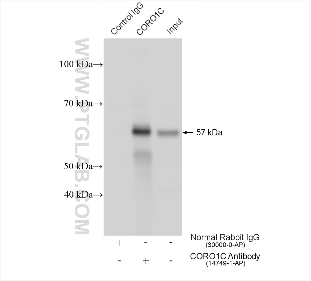 Immunoprecipitation (IP) experiment of mouse heart tissue using CORO1C Polyclonal antibody (14749-1-AP)