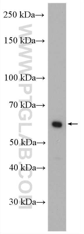 Western Blot (WB) analysis of SGC-7901 cells using CORO1C Polyclonal antibody (14749-1-AP)