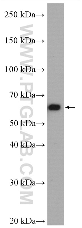 Western Blot (WB) analysis of mouse heart tissue using CORO1C Polyclonal antibody (14749-1-AP)