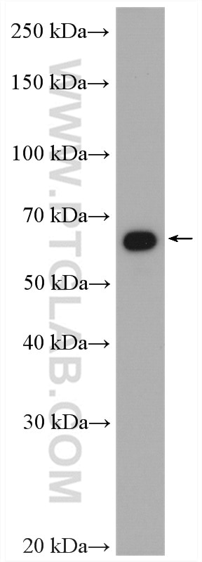 Western Blot (WB) analysis of mouse skeletal muscle tissue using CORO1C Polyclonal antibody (14749-1-AP)