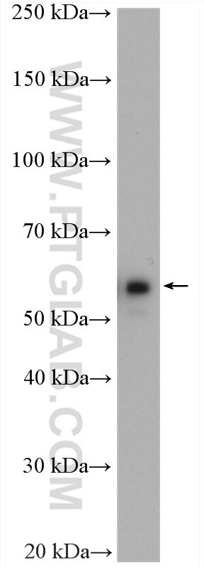 Western Blot (WB) analysis of SGC-7901 cells using CORO1C Polyclonal antibody (14749-1-AP)