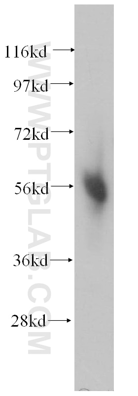 Western Blot (WB) analysis of human heart tissue using CORO1C Polyclonal antibody (14749-1-AP)