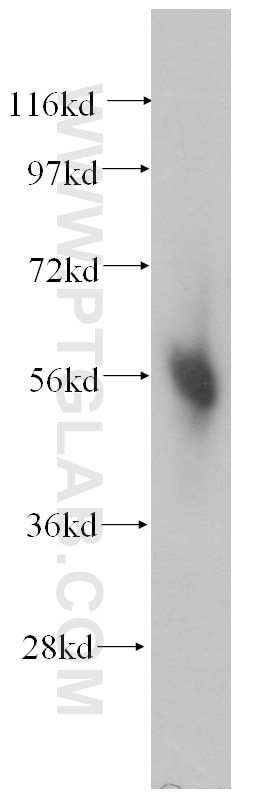 WB analysis of human heart using 14749-1-AP