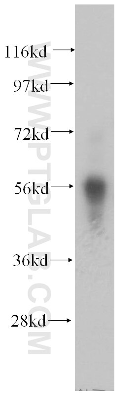 CORO1C Polyclonal antibody