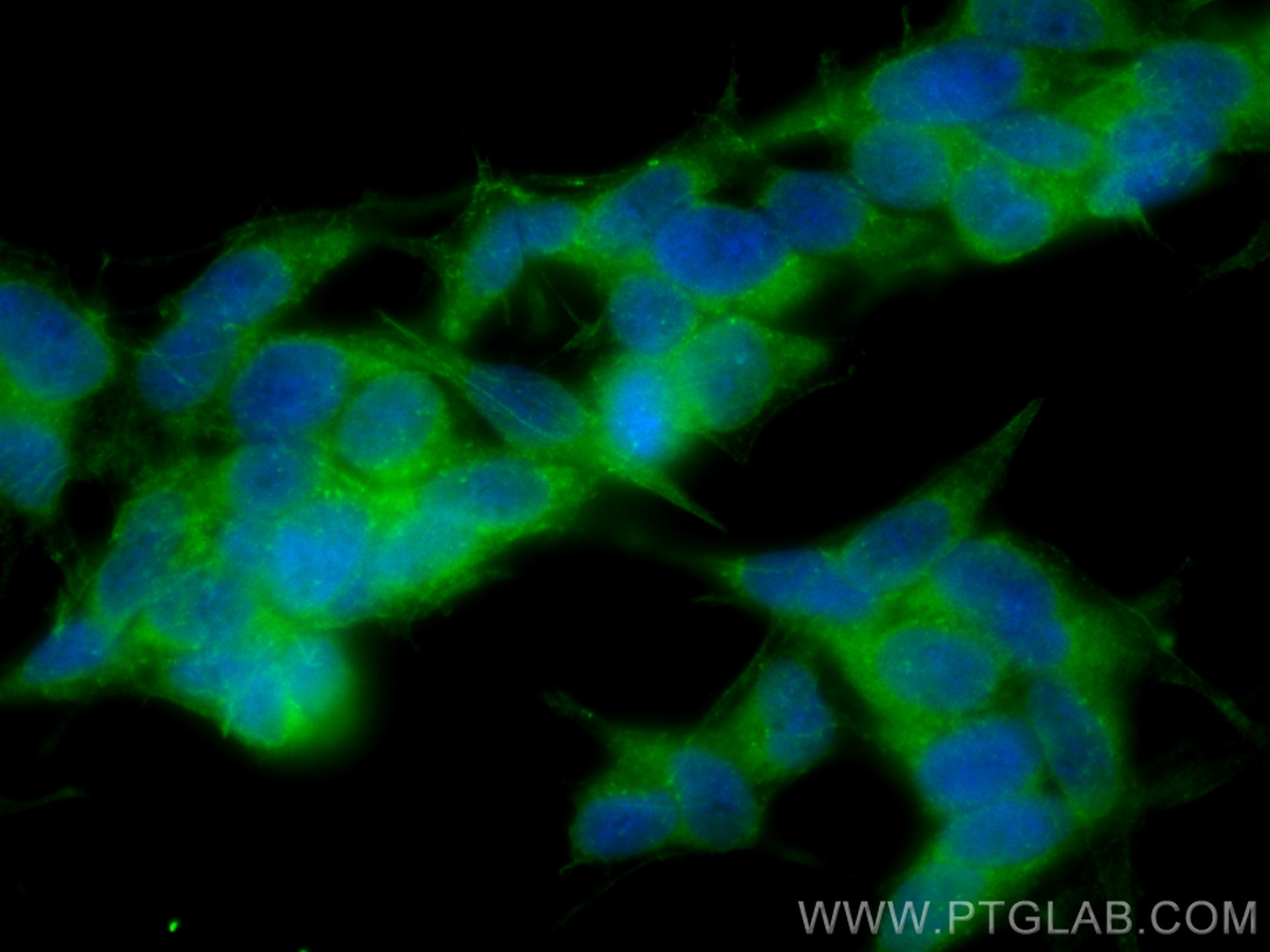 Immunofluorescence (IF) / fluorescent staining of SH-SY5Y cells using CoraLite® Plus 488-conjugated CORO1C Polyclonal an (CL488-14749)