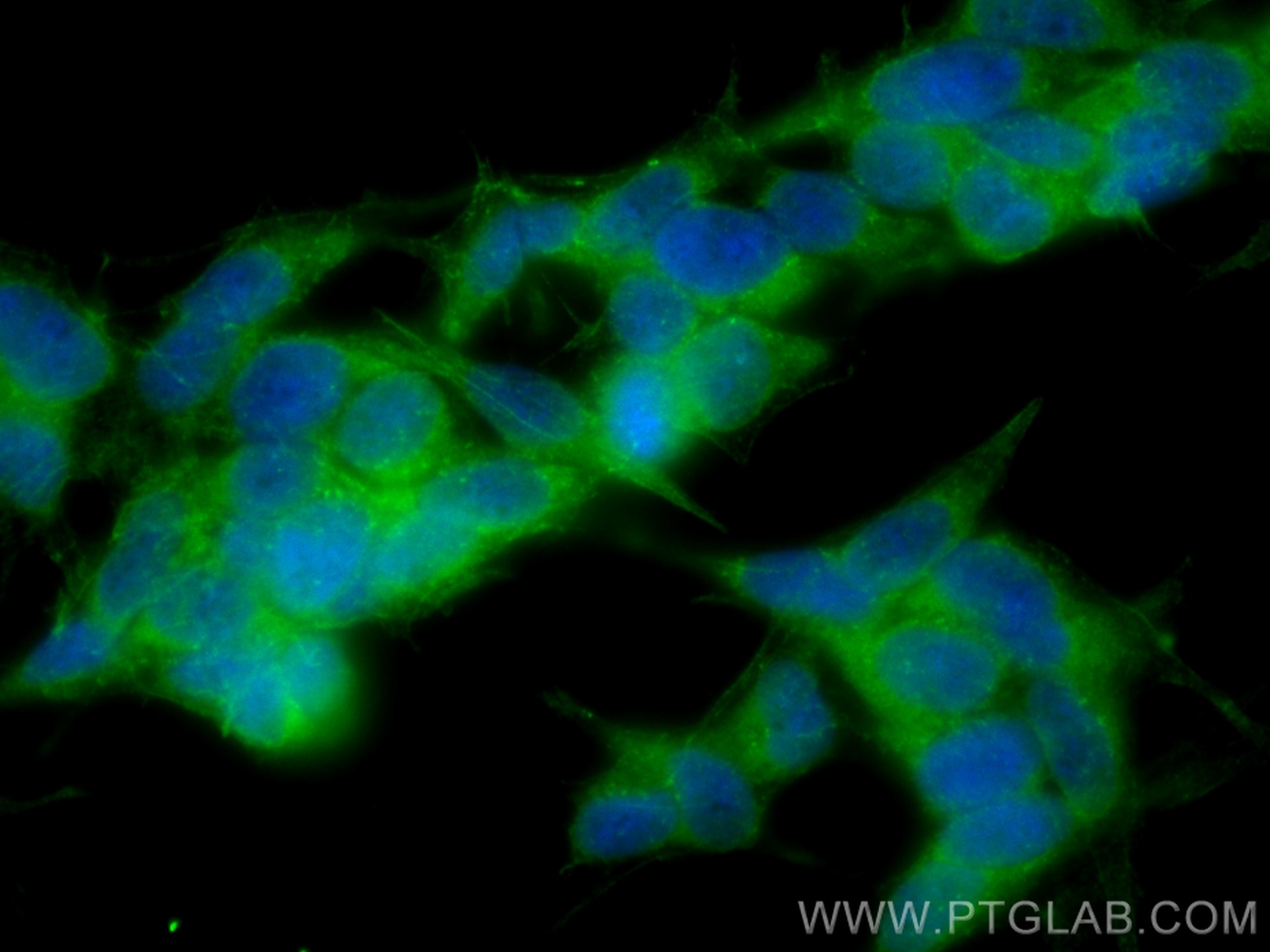 IF Staining of SH-SY5Y using CL488-14749