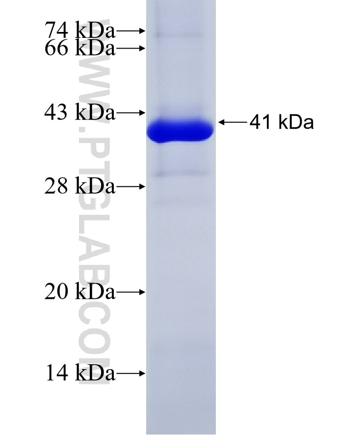 CORO1C fusion protein Ag6546 SDS-PAGE