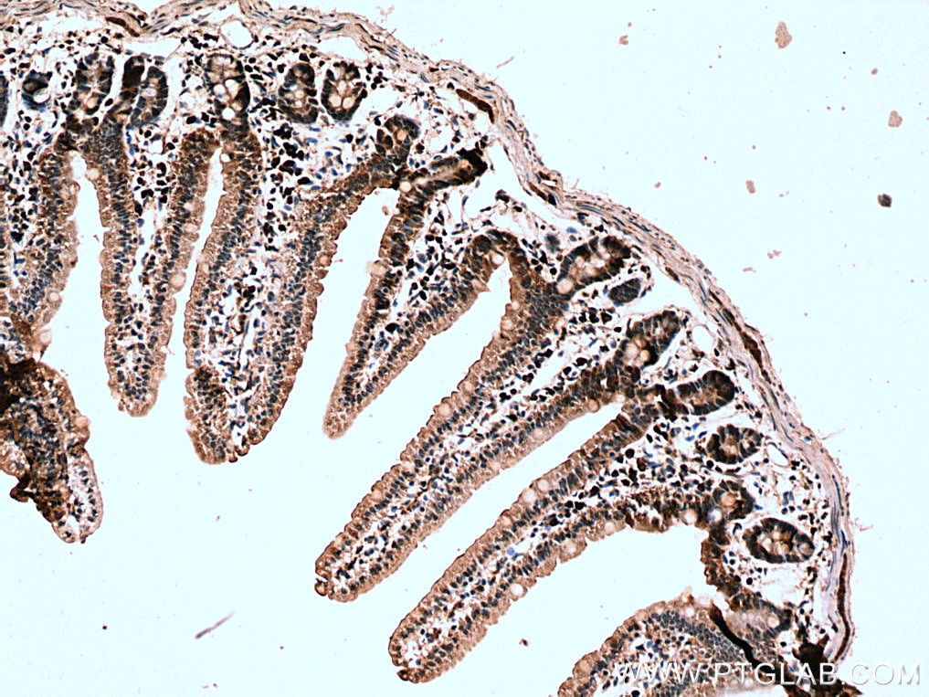 Immunohistochemistry (IHC) staining of mouse small intestine tissue using CORO2A Polyclonal antibody (10119-1-AP)