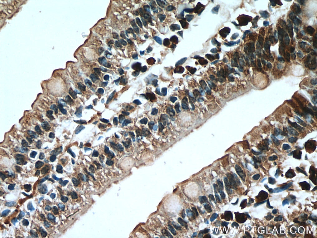 Immunohistochemistry (IHC) staining of mouse small intestine tissue using CORO2A Polyclonal antibody (10119-1-AP)