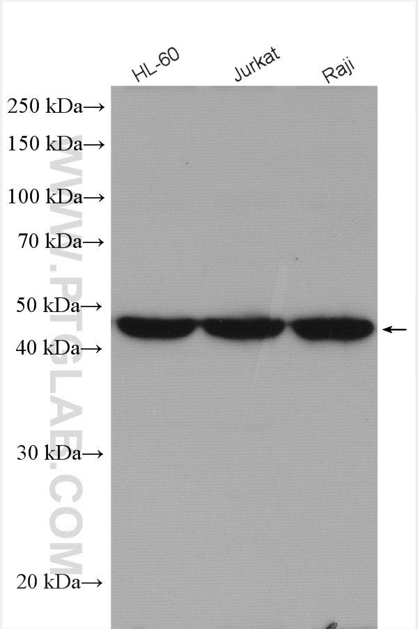 Western Blot (WB) analysis of various lysates using CORO2A Polyclonal antibody (10119-1-AP)