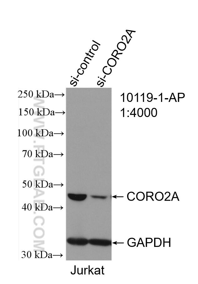 Western Blot (WB) analysis of Jurkat cells using CORO2A Polyclonal antibody (10119-1-AP)