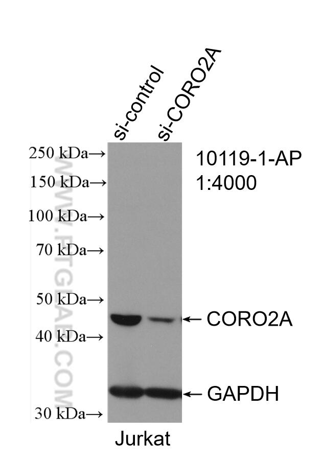 WB analysis of Jurkat using 10119-1-AP