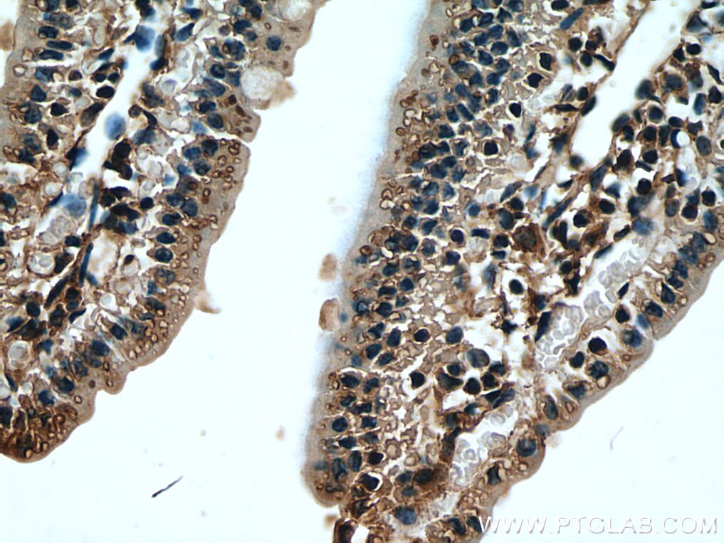 Immunohistochemistry (IHC) staining of mouse small intestine tissue using CORO2A Polyclonal antibody (28883-1-AP)