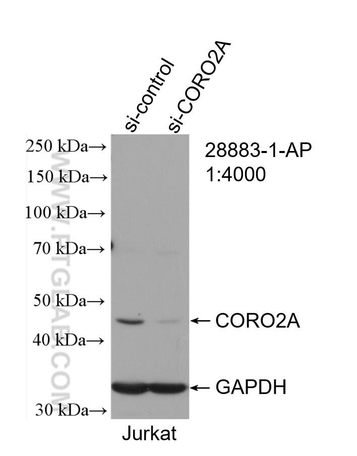 Western Blot (WB) analysis of Jurkat cells using CORO2A Polyclonal antibody (28883-1-AP)