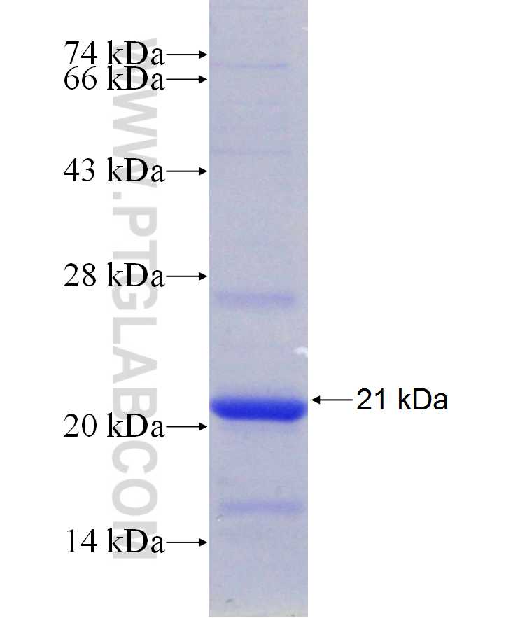 CORO2A fusion protein Ag29696 SDS-PAGE