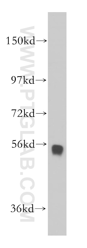 Western Blot (WB) analysis of mouse brain tissue using CORO2B Polyclonal antibody (13802-1-AP)